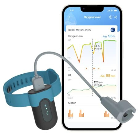 Viatom SleepU Pulsoximeter Handgelenk, Bluetooth Puls Oximeter Sauerstoffsättigung Messgerät Finger, Pulsoximeter Fingeroximeter, Sauerstoffsättigung Schlafmonitor, Vibrations Erinnern, Kostenlose APP