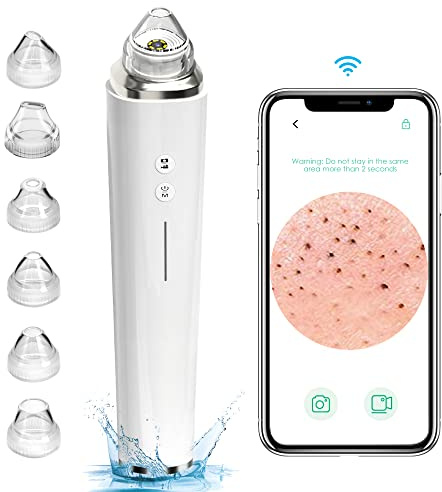 Prabensei Mitesserentferner mit Kamera, Vakuum-Sauger Porenreiniger 20X Mikroskop 5.0 MP, 3 Saugstufen & 6 LED-Licht & 6 Sonden