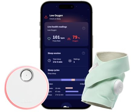 Owlet Dream Sock – Smarte Babyüberwachung mit App | Sensorbasiertes Babyphone-System mit Schlaftracking & Benachrichtigungen | 0–18 Monate| Mint