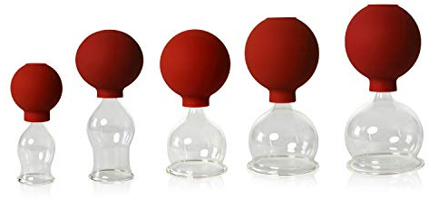 Lauschaer Glas 5er Schröpfglas-Set mit Ball 25-35-45-55-60mm zum professionellen, medizinischen, feuerlosen Schröpfen, Schröpfglas, Schröpfgläser, Original