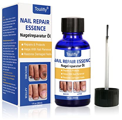 Nagelpflege und Behandlung, NägelReparatur,Nagelpflege für gesunde Fuß und Hand, Nagelöl, Nagelpflegeöl, Nagelpflege pflegend, Nail Essence Serum, Fur Gebrochene und Verfärbte Nägel
